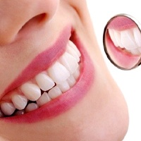 Healthy smile and dental mirror