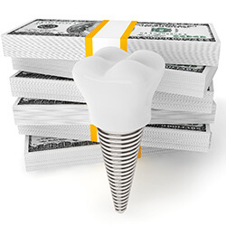Money and model implant representing cost of dental implants in Midwest City