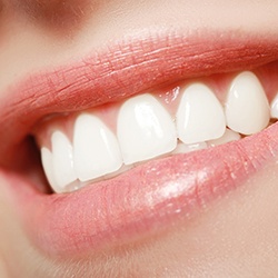 Close-up of woman smiling with dental implants in Midwest City, OK