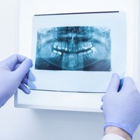 Dentist holding up an X-ray