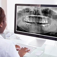 Digital dental X-ray on chairside computer