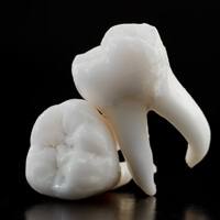 A pair of extracted teeth