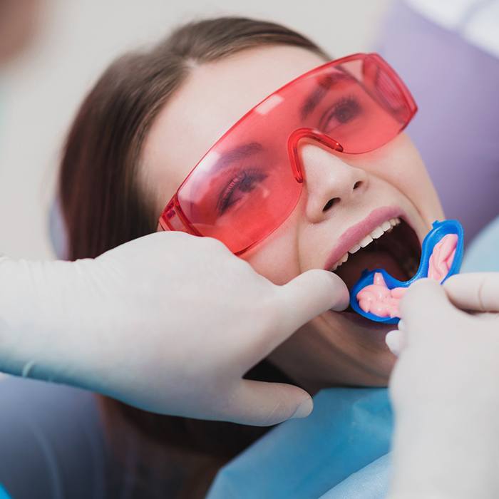 A woman getting fluoride treatment