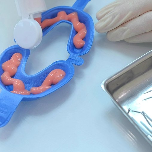 Fluoride foam in a tray