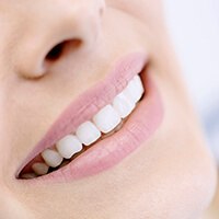 Woman with a bright smile after teeth whitening