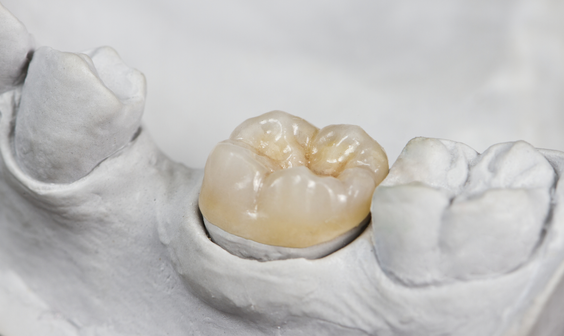 What can my Midwest City Dentist do about my broken tooth? 