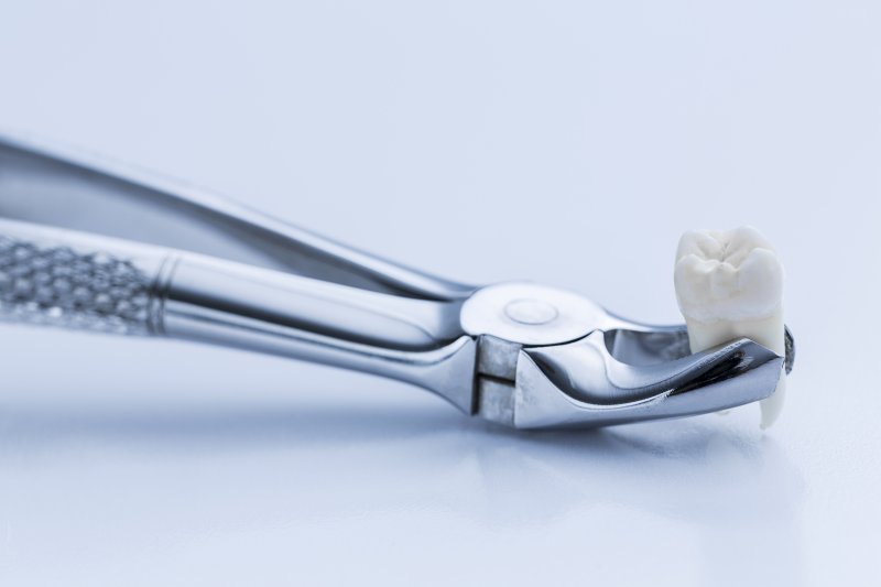 Tooth Extraction Recovery in Midwest City Midwest Dental Center