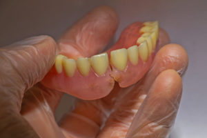 Gloved hand holding a broken denture 