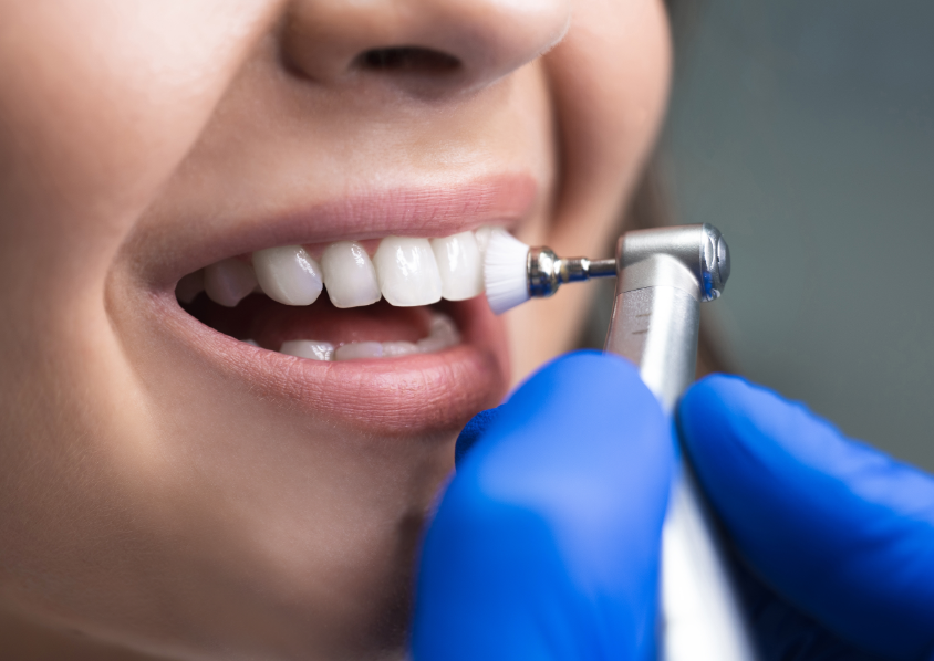 Close up of patient's teeth being cleaned